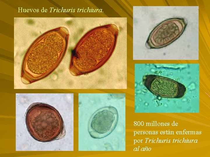 Huevos de Trichuris trichiura. 800 millones de personas están enfermas por Trichuris trichiura al