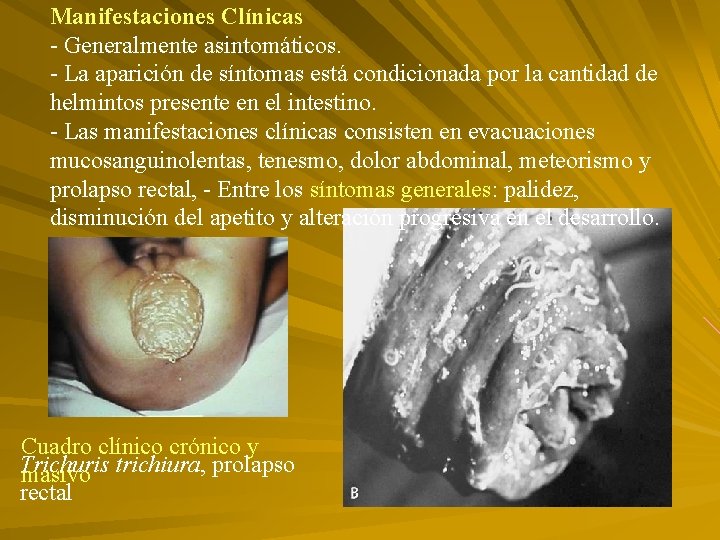 Manifestaciones Clínicas - Generalmente asintomáticos. - La aparición de síntomas está condicionada por la