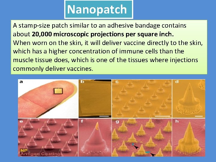 Nanopatch A stamp-size patch similar to an adhesive bandage contains about 20, 000 microscopic