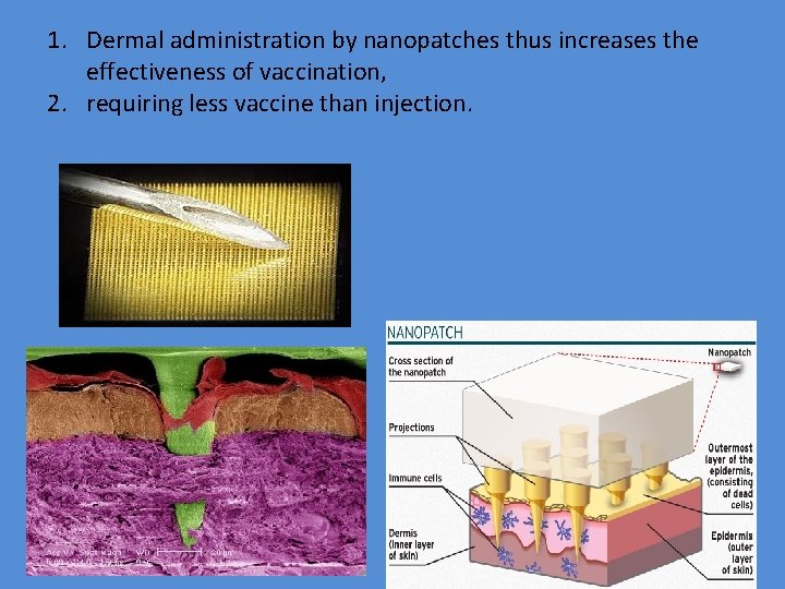 1. Dermal administration by nanopatches thus increases the effectiveness of vaccination, 2. requiring less