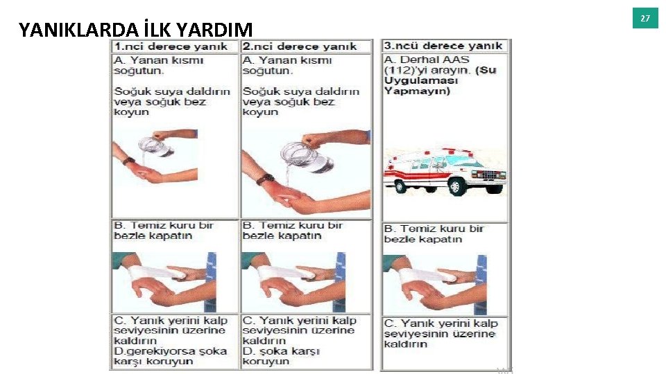 YANIKLARDA İLK YARDIM 27 