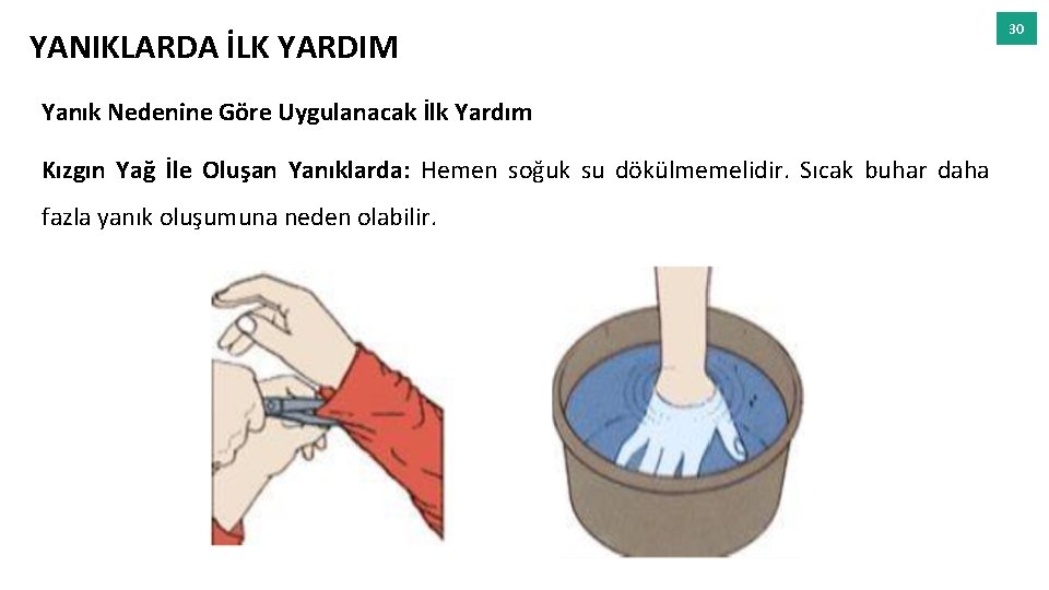 YANIKLARDA İLK YARDIM Yanık Nedenine Göre Uygulanacak İlk Yardım Kızgın Yağ İle Oluşan Yanıklarda: