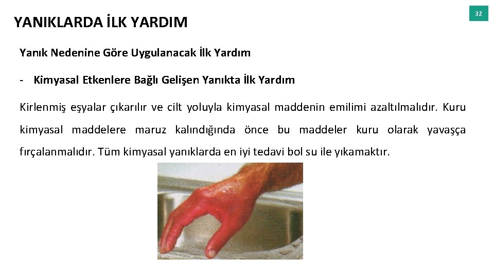 YANIKLARDA İLK YARDIM Yanık Nedenine Göre Uygulanacak İlk Yardım - Kimyasal Etkenlere Bağlı Gelişen