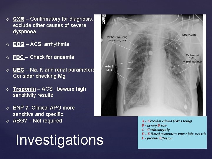 o CXR – Confirmatory for diagnosis; exclude other causes of severe dyspnoea o ECG