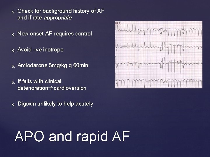  Check for background history of AF and if rate appropriate New onset AF