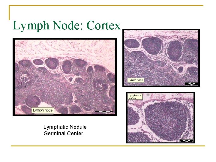 Lymph Node: Cortex Lymphatic Nodule Germinal Center 