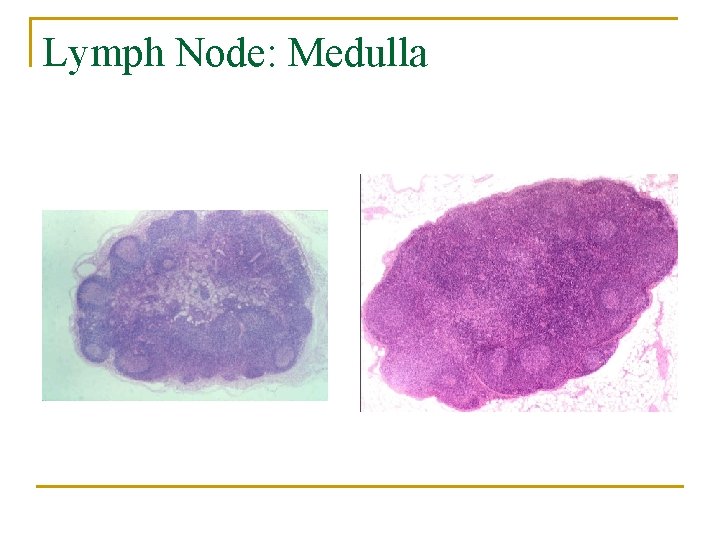 Lymph Node: Medulla 