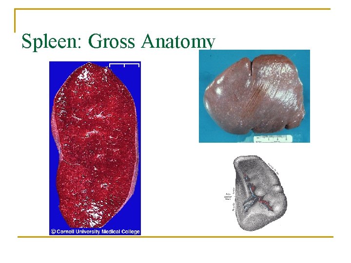 Spleen: Gross Anatomy 