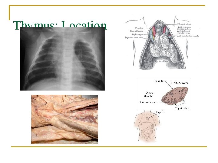 Thymus: Location 