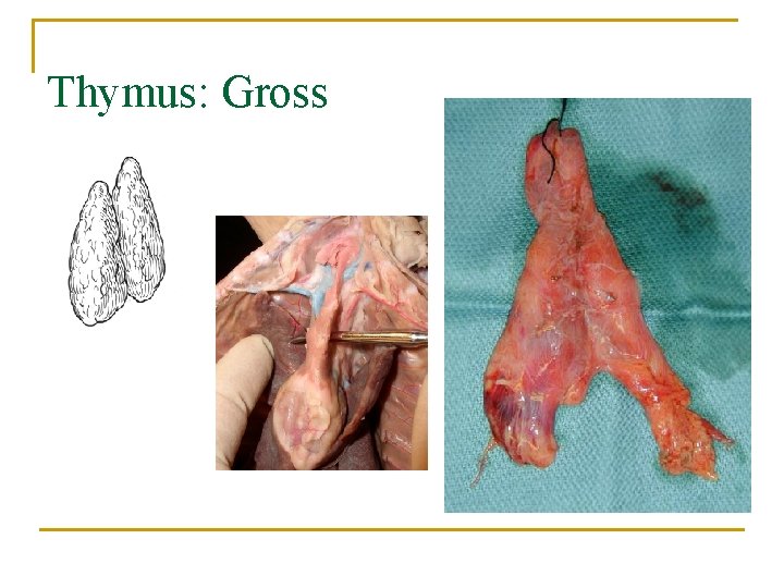 Thymus: Gross 