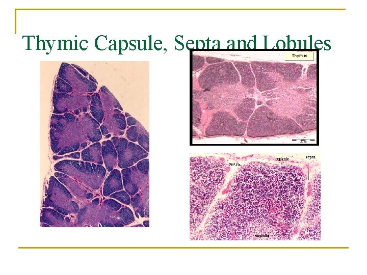 Thymic Capsule, Septa and Lobules 