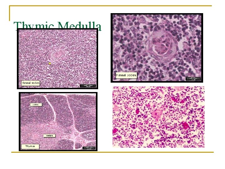 Thymic Medulla 