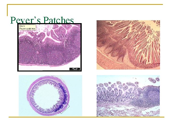 Peyer’s Patches 