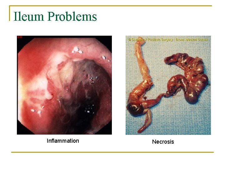 Ileum Problems Inflammation Necrosis 