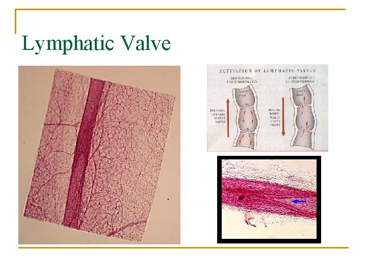 Lymphatic Valve 