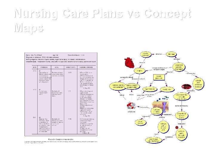 Nursing Care Plans vs Concept Maps NCP Concept/Mind Map 