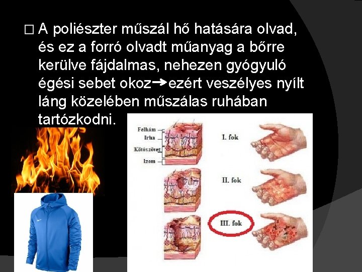 �A poliészter műszál hő hatására olvad, és ez a forró olvadt műanyag a bőrre