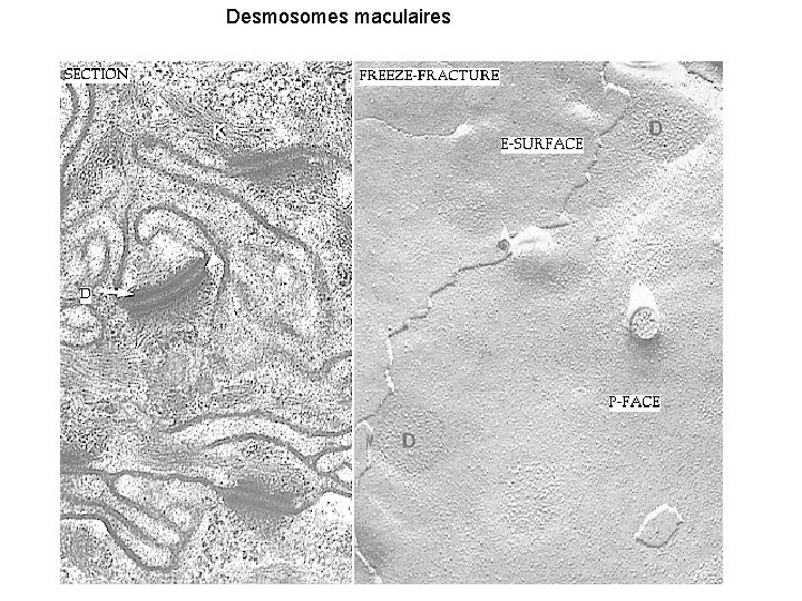 Desmosomes maculaires 