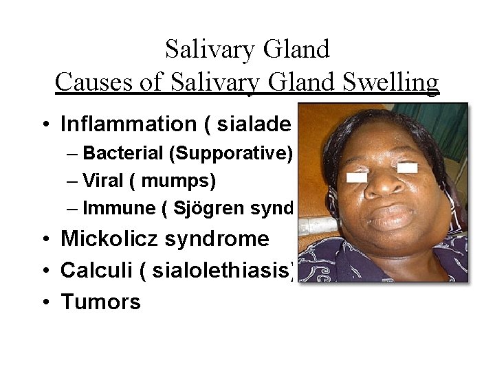 Salivary Gland Causes of Salivary Gland Swelling • Inflammation ( sialadenitis) – Bacterial (Supporative)