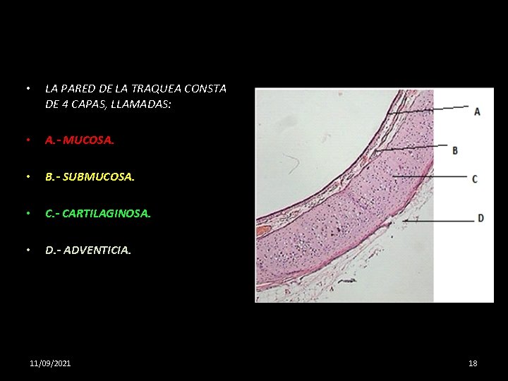  • LA PARED DE LA TRAQUEA CONSTA DE 4 CAPAS, LLAMADAS: • A.