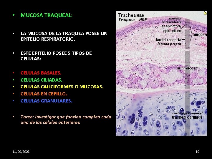  • MUCOSA TRAQUEAL: • LA MUCOSA DE LA TRAQUEA POSEE UN EPITELIO RESPIRATORIO.