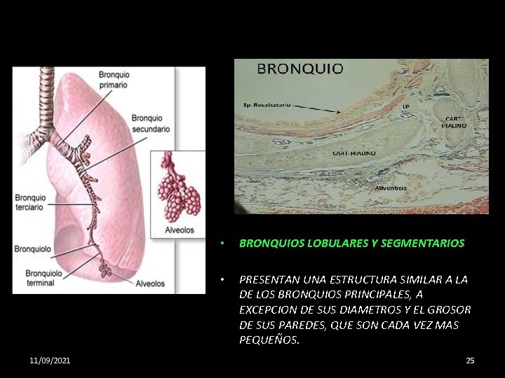 11/09/2021 • BRONQUIOS LOBULARES Y SEGMENTARIOS • PRESENTAN UNA ESTRUCTURA SIMILAR A LA DE