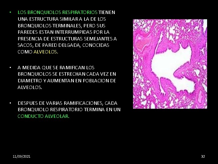  • LOS BRONQUIOLOS RESPIRATORIOS TIENEN UNA ESTRUCTURA SIMILAR A LA DE LOS BRONQUIOLOS