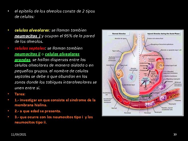  • el epitelio de los alveolos consta de 2 tipos de celulas: •