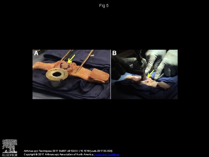 Fig 5 Arthroscopy Techniques 2017 6 e 907 -e 912 DOI: (10. 1016/j. eats.