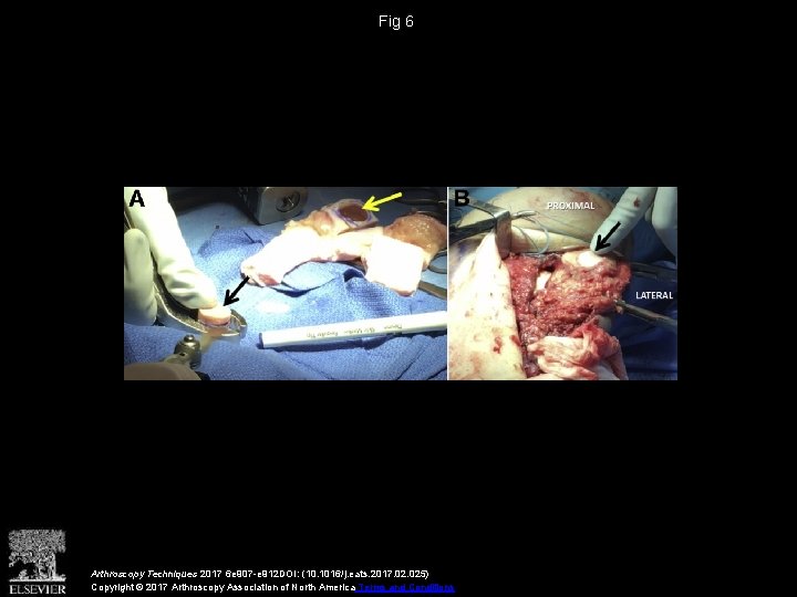 Fig 6 Arthroscopy Techniques 2017 6 e 907 -e 912 DOI: (10. 1016/j. eats.