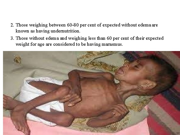 2. Those weighing between 60 -80 per cent of expected without edema are known