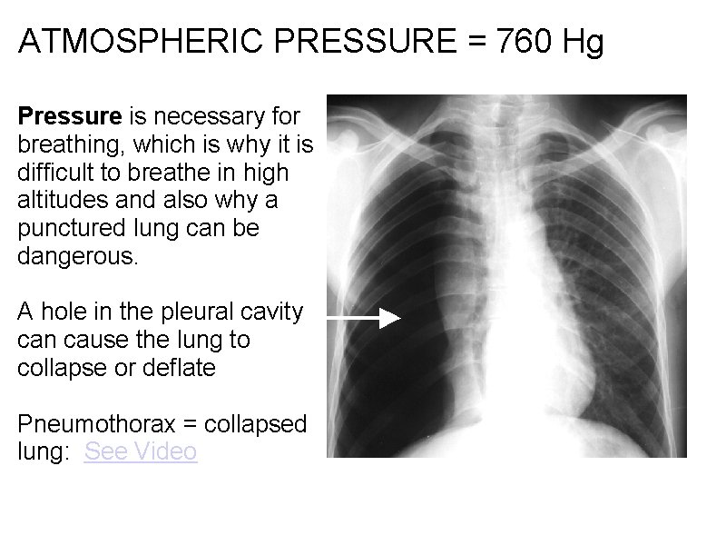 ATMOSPHERIC PRESSURE = 760 Hg Pressure is necessary for breathing, which is why it ATMOSPHERIC PRESSURE = 760 Hg Pressure is necessary for breathing, which is why it