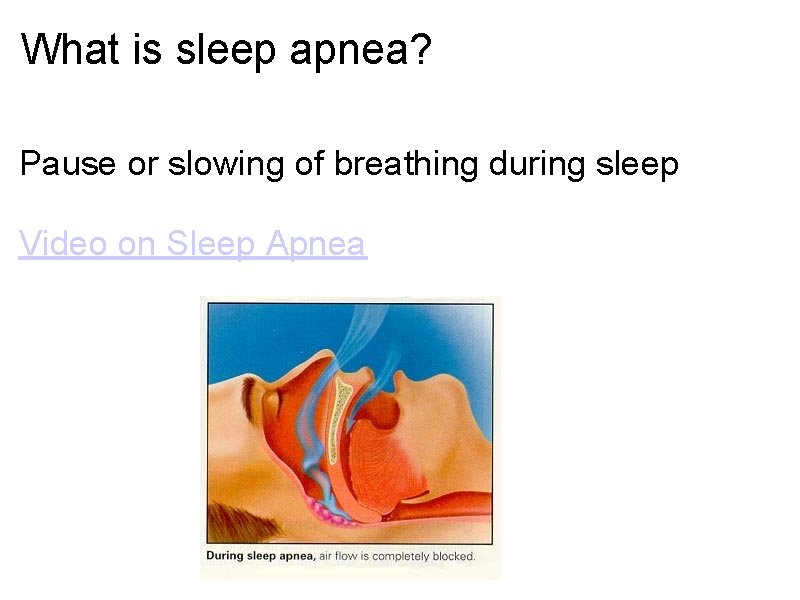 What is sleep apnea? Pause or slowing of breathing during sleep Video on Sleep What is sleep apnea? Pause or slowing of breathing during sleep Video on Sleep