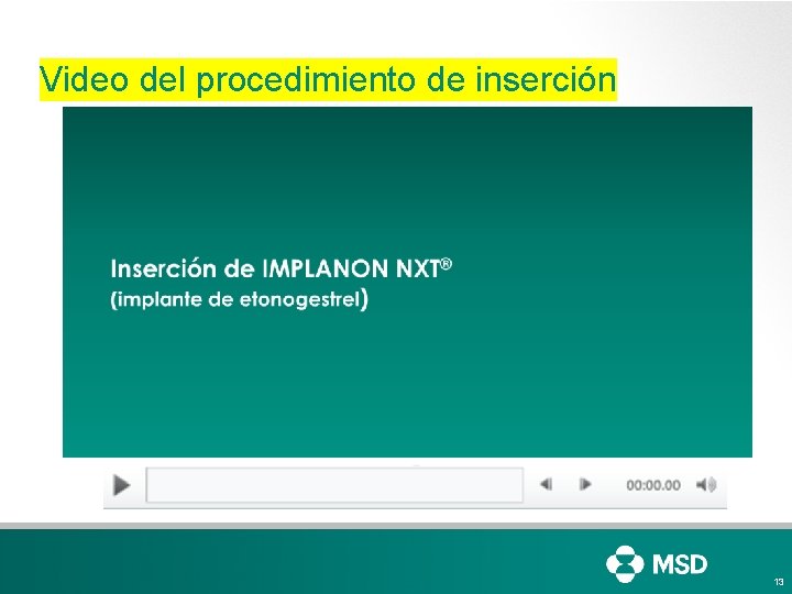 Video del procedimiento de inserción 13 Video del procedimiento de inserción 13