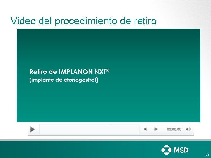 Video del procedimiento de retiro 21 Video del procedimiento de retiro 21