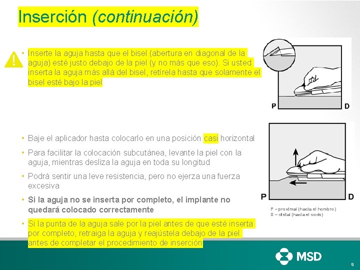 Inserción (continuación) • Inserte la aguja hasta que el bisel (abertura en diagonal de Inserción (continuación) • Inserte la aguja hasta que el bisel (abertura en diagonal de