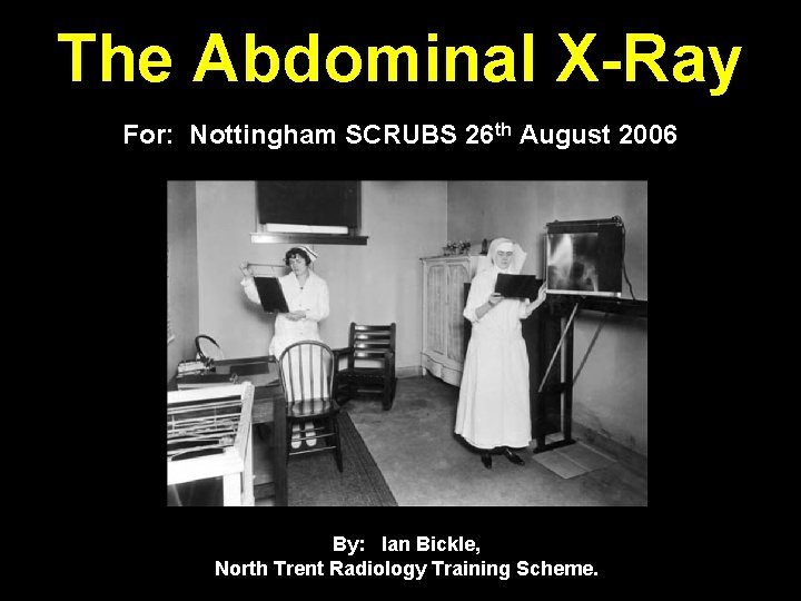 The Abdominal X-Ray For: Nottingham SCRUBS 26 th August 2006 By: Ian Bickle, North