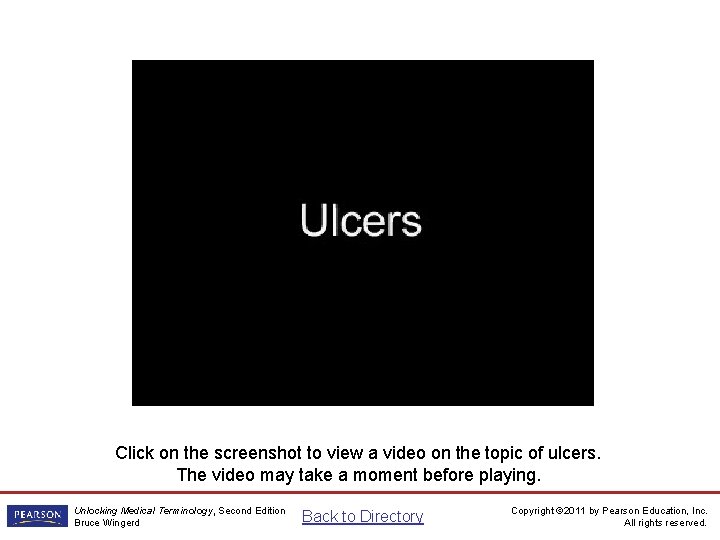 Ulcers Video Click on the screenshot to view a video on the topic of Ulcers Video Click on the screenshot to view a video on the topic of