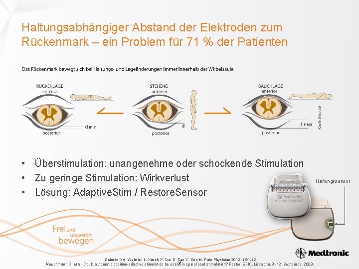 Haltungsabhängiger Abstand der Elektroden zum Rückenmark – ein Problem für 71 % der Patienten