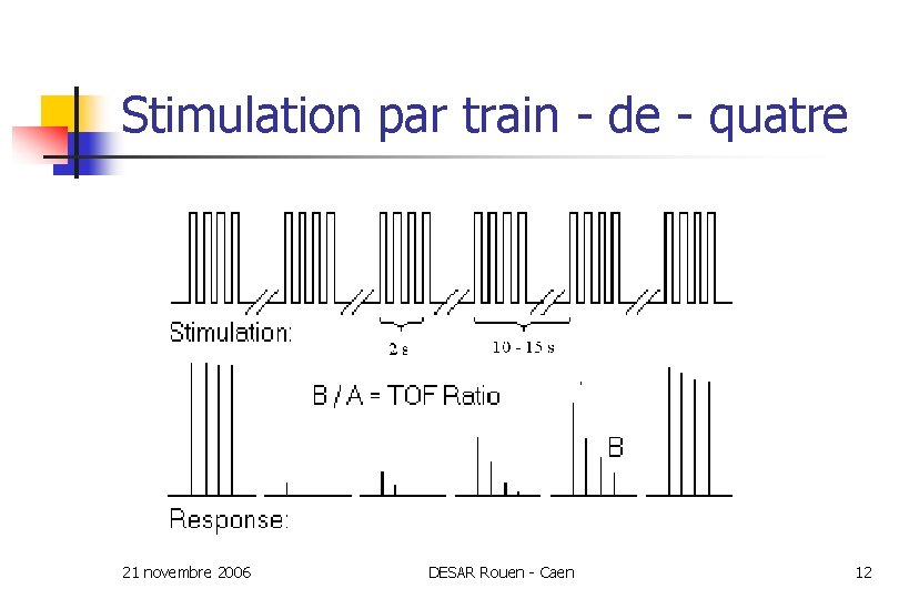 Stimulation par train - de - quatre 21 novembre 2006 DESAR Rouen - Caen