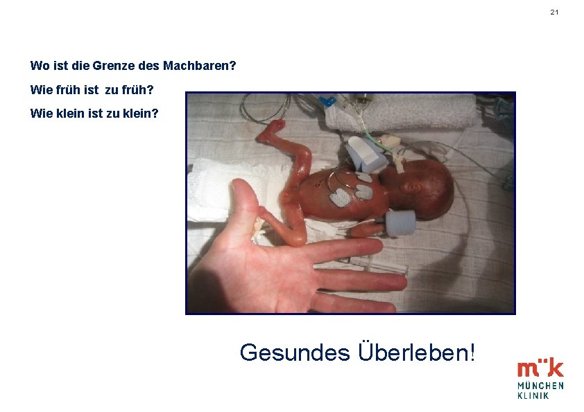 21 Wo ist die Grenze des Machbaren? Wie früh ist zu früh? Wie klein