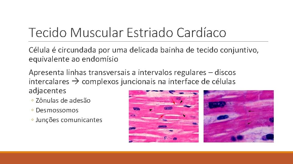 Tecido Muscular Estriado Cardíaco Célula é circundada por uma delicada bainha de tecido conjuntivo,