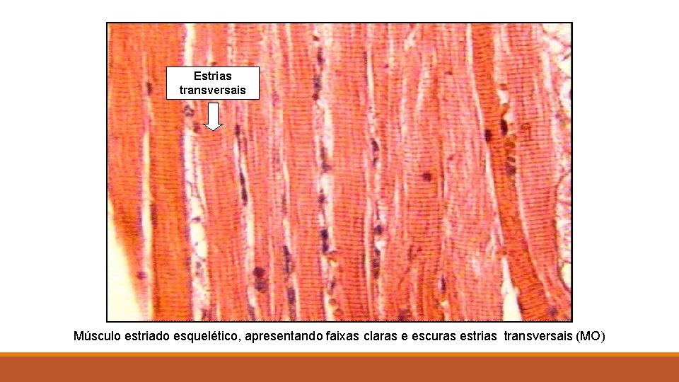 Estrias transversais Músculo estriado esquelético, apresentando faixas claras e escuras estrias transversais (MO) 