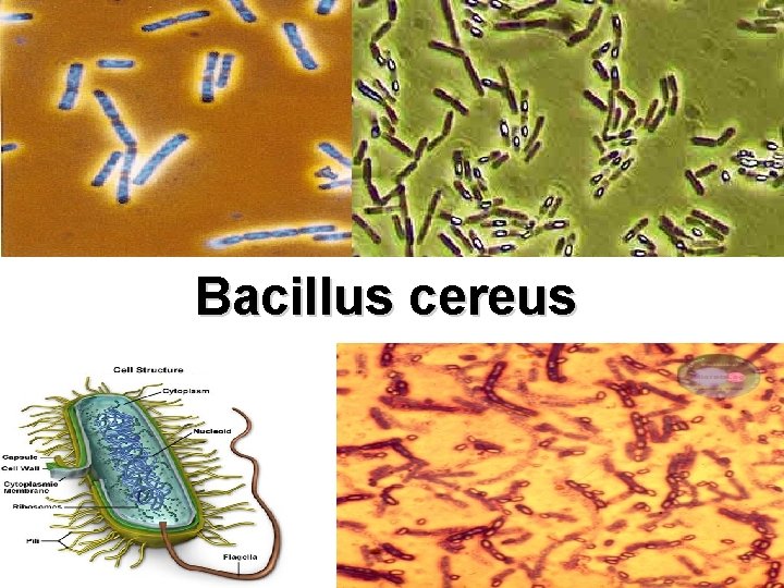 Bacillus cereus 