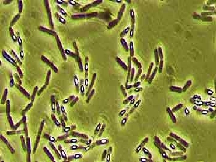 Bacillus cereus Caratteristiche generali Il Bacillus cereus un