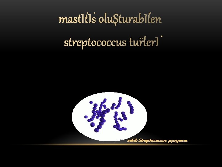 sekil: Streptococcus pyogenes 