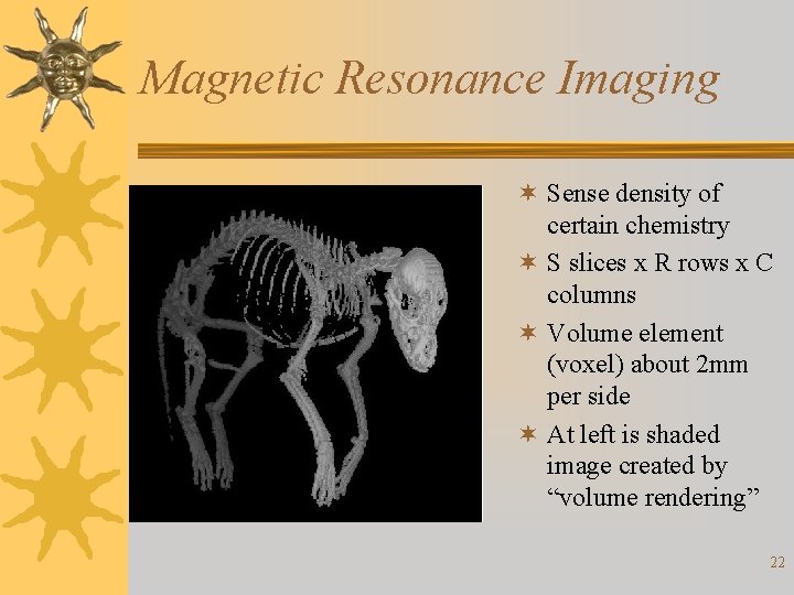 Magnetic Resonance Imaging ¬ Sense density of certain chemistry ¬ S slices x R