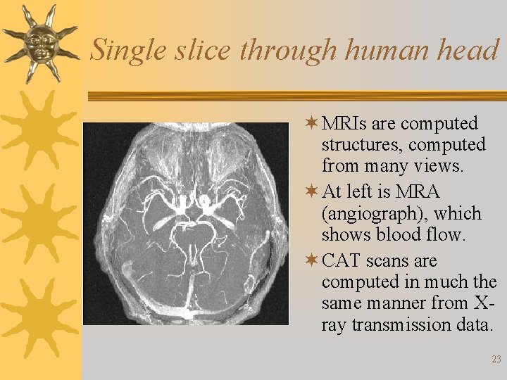 Single slice through human head ¬ MRIs are computed structures, computed from many views.