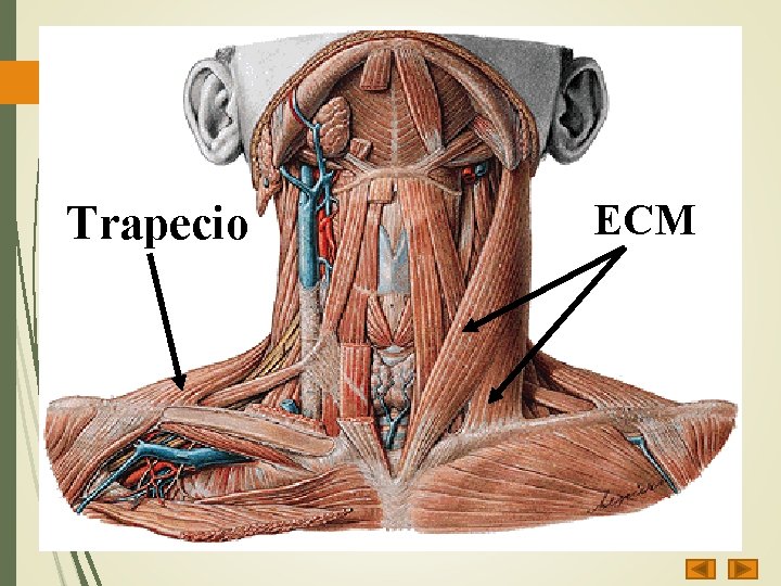 Trapecio ECM 