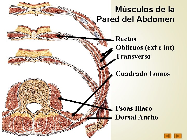 Músculos de la Pared del Abdomen Rectos Oblicuos (ext e int) Transverso Cuadrado Lomos